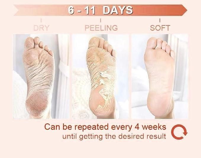 Exfoliating Foot Mask