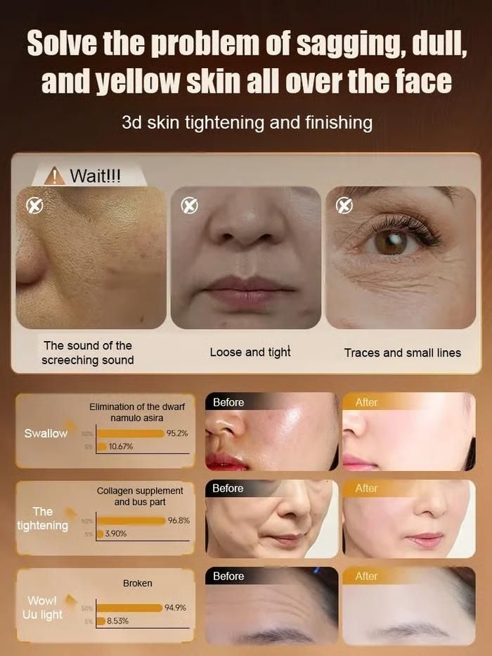 Skin Rejuvenation Essence 50 ml Pack of 1